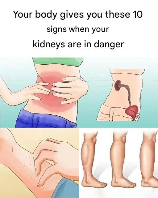 10 symptoms of kidney disease