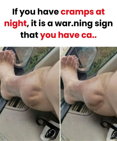 The Kidney’s Role in Muscle Health