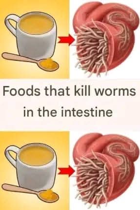 7 Foods That Kill Worms in the Intestine