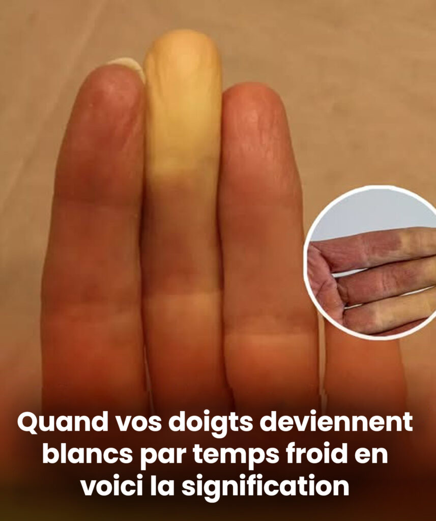 Quand le froid blanchit vos doigts : Comprendre ce message d’alerte de votre organisme