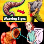 15 signes silencieux du cancer du pancréas que vous devez connaître