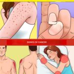 12 signes avant-coureurs de la présence de cellules cancéreuses dans votre corps 586726764_1468230357581439_1308250982545980180_n