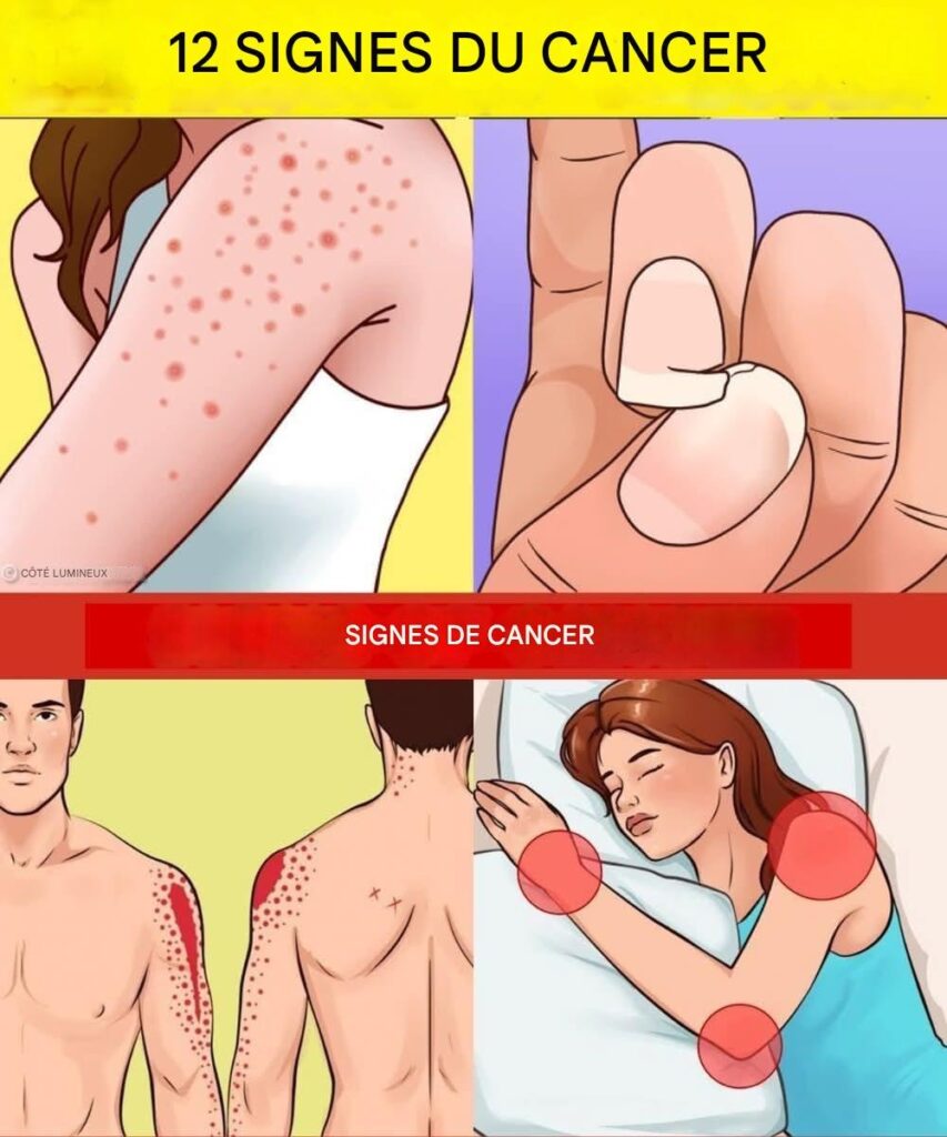 12 signes avant-coureurs de la présence de cellules cancéreuses dans votre corps