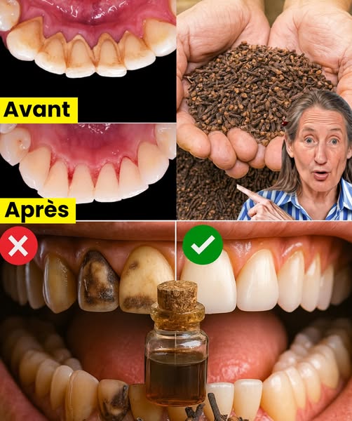 9 Astuces Naturelles pour une Hygiène Bucco-Dentaire Douce et Efficace