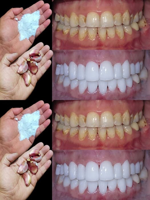 Comment blanchir les dents en 2 minutes ?