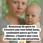 Parfois, le monde ne voit que les différences. 595856513_2054534705296331_1715722498826018493_n