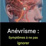 Anévrisme : les symptômes à ne pas ignorer 598436886_122175359606470278_4921059596649538042_n